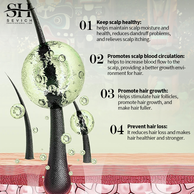 Sevich India Herbal Hair Growt - đánh giá và giá Ayurvedic & Herbal Wellness Kits